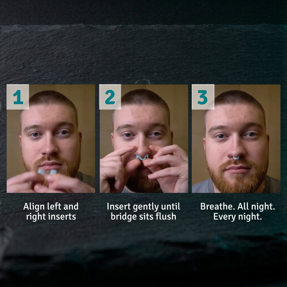 Flowlift Nasal Dilator