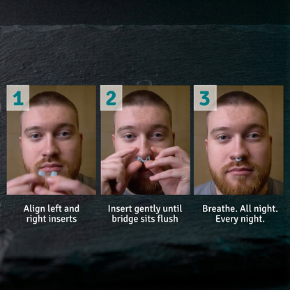 Flowlift Nasal Dilator